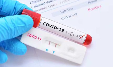 प्रधानमंत्री मोदी से मिलना है तो पहले RT-PCR कराएं, बढ़ते केस के बीच मंत्रियों को निर्देश