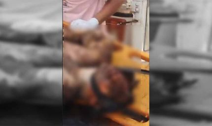 अहमदाबाद प्लेन क्रैश : सड़कों पर जले हुए शव पड़े हैं, जिनकी पहचान तक करना मुश्किल