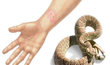 सर्प-दंश से जन-सामान्य के बचाव के लिए राज्य आपदा प्रबंधन प्राधिकरण द्वारा एडवाइजरी जारी