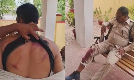 बालोद में पर्रकुलेशन टेंक का निरीक्षण करने पहुंची वन विभाग की टीम पर लाठी-डंडे से हमला, डिप्टी रेंजर समेत 4 घायल