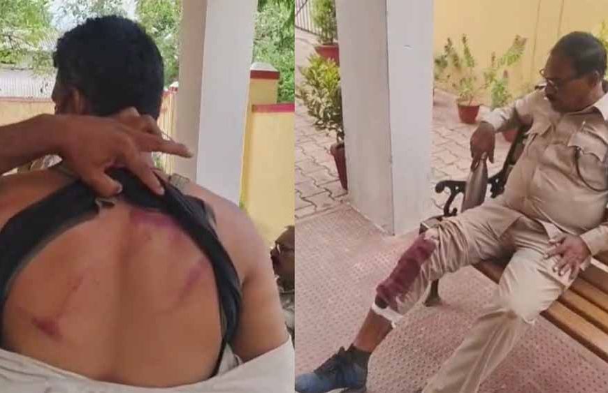 बालोद में पर्रकुलेशन टेंक का निरीक्षण करने पहुंची वन विभाग की टीम पर लाठी-डंडे से हमला, डिप्टी रेंजर समेत 4 घायल
