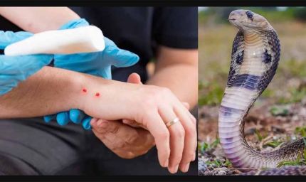 सांप काटने पर सीधे पहुंचे अस्पताल स्वास्थ्य विभाग ने जारी की एडवायजरी