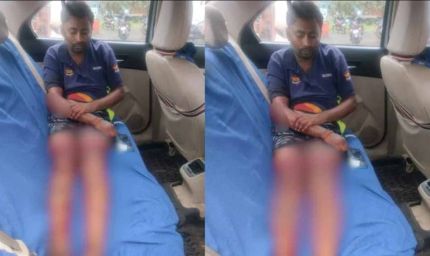 चॉइस सेंटर संचालक पर जानलेवा हमला, पुरानी रंजिश बनी वजह