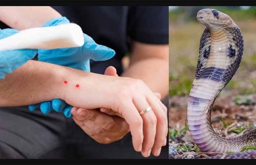 सांप काटने पर सीधे पहुंचे अस्पताल स्वास्थ्य विभाग ने जारी की एडवायजरी