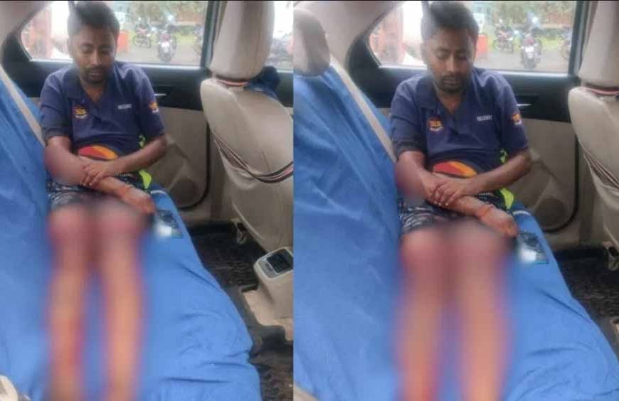 चॉइस सेंटर संचालक पर जानलेवा हमला, पुरानी रंजिश बनी वजह
