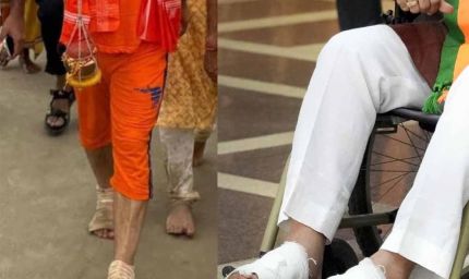 कांवड़ यात्रा के बाद 110 किमी पैदल चलने से सांसद के पैरों में समस्या, व्हीलचेयर से संसद पहुंचने पर चिंता