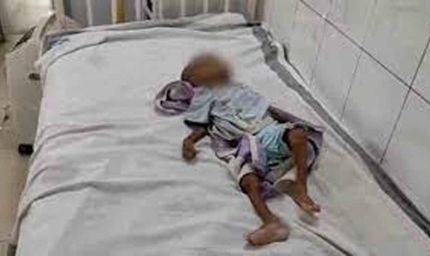 शिवपुरी में कुपोषण से मासूम की मौत, बेटे की चाहत में दादी ने नहीं कराया इलाज