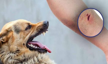 इंदौर में डॉग बाइट के मामले बढ़े, 7 महीने में 28,142 लोग बने शिकार