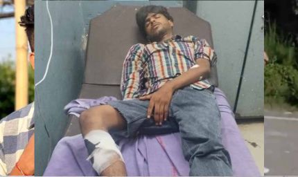 एल्विश यादव के घर फायरिंग का आरोपी पकड़ा गया, पुलिस एनकाउंटर में पैर में लगी गोली