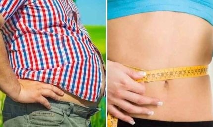 MP को मिलेगा पहला सरकारी ओबेसिटी क्लीनिक, जांच से सर्जरी तक सब फ्री