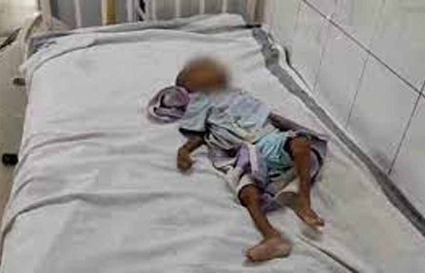 शिवपुरी में कुपोषण से मासूम की मौत, बेटे की चाहत में दादी ने नहीं कराया इलाज