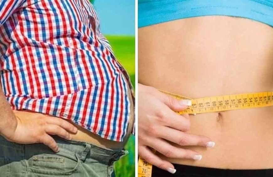 MP को मिलेगा पहला सरकारी ओबेसिटी क्लीनिक, जांच से सर्जरी तक सब फ्री