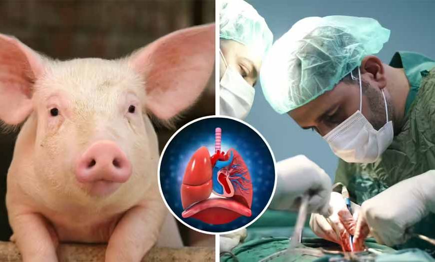 ब्रेन डेड मरीज पर पहली बार सूअर का फेफड़ा लगाया गया, साइंस ने कर दिखाया करिश्मा