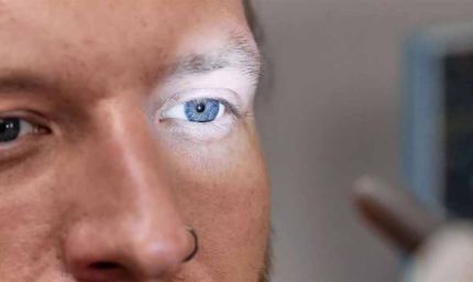 कार्निया ट्रांसप्लांट मरीजों के लिए बड़ी सुविधा: एम्स ला रहा नया ऐप, देश भर के आई-बैंकों की पूरी जानकारी