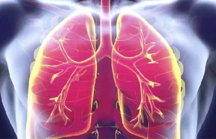 मध्य प्रदेश में ‘मेलिओइडोसिस’ का खतरा बढ़ा, लक्षणों से डॉक्टर भी हो रहे भ्रमित