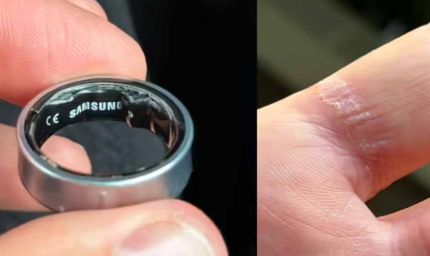 स्‍मार्ट रिंग बनी मुसीबत: एयरपोर्ट पर रोका गया यात्री, पहुंचा अस्‍पताल