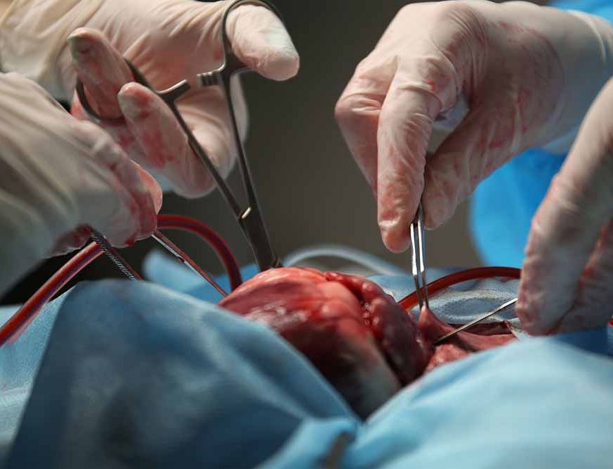 मौत से जिंदगी तक: पहला ट्रांसप्लांट जिसने दुनिया को हिला दिया!