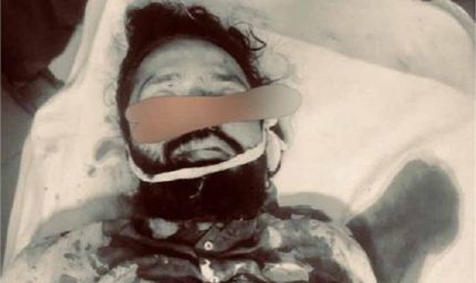 लश्कर का बड़ा आतंकी शेख मोइज ढेर! हाफिज सईद के करीबी की दिनदहाड़े गोली मारकर हत्या