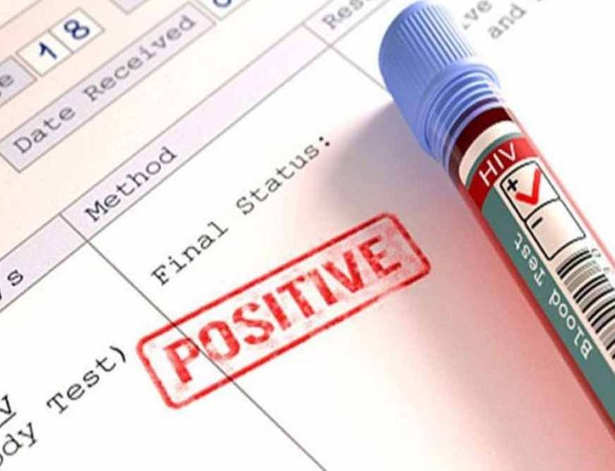 HIV रिपोर्ट गोपनीयता पर नई गाइडलाइन: अब सिर्फ डॉक्टर ही देख सकेंगे मरीज की जानकारी