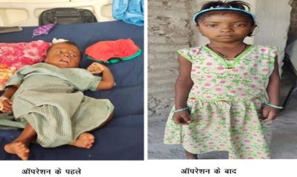 रायपुर : चिरायु योजना बच्चों के लिए भी बनी वरदान