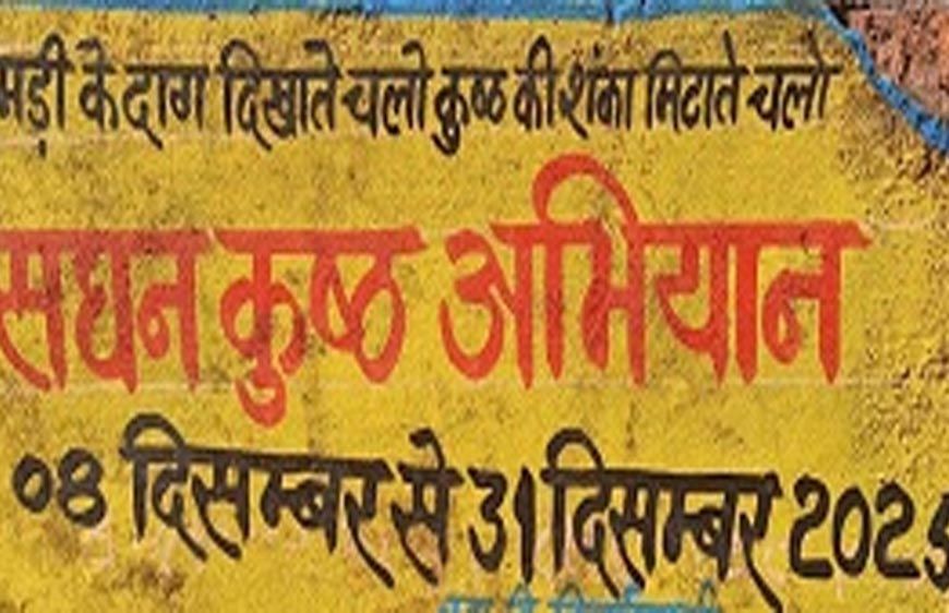 एमसीबी : सघन कुष्ठ खोज अभियान - घर-घर पहुंच रही स्वास्थ्य विभाग की टीम