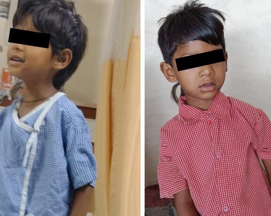 रायपुर : चिरायु योजना से नित्या राजवाड़े को मिला नया जीवन