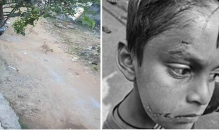 बिलासपुर में PM श्री स्कूल के अंदर कुत्ते ने पहली कक्षा के बच्चे को नोचा, बचाने दौड़ी टीचर पर भी किया हमला