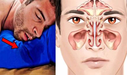 गहरी नींद का संकेत है या कोई बीमारी? सोते समय मुंह से लार बहने पर रहें अलर्ट?