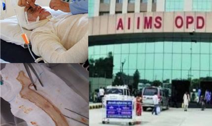 बिहार का पहला स्किन बैंक तैयार, पटना एम्स में जलने वाले मरीजों को अब मिलेगा नया जीवन