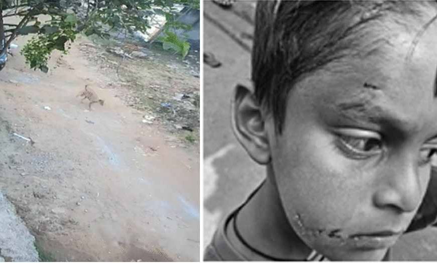 बिलासपुर में PM श्री स्कूल के अंदर कुत्ते ने पहली कक्षा के बच्चे को नोचा, बचाने दौड़ी टीचर पर भी किया हमला