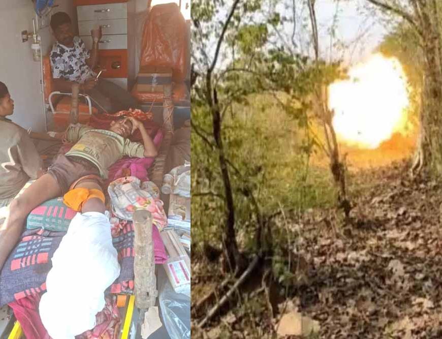 प्रेशर IED विस्फोट की चपेट में आया ग्रामीण बालक, हालत नाजुक