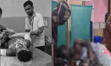 मंगल कार्बन प्लांट में भीषण ब्लास्ट: 9 माह के मासूम सहित 8 मजदूर झुलसे, हालत नाजुक