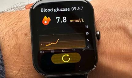 क्या स्मार्टवॉच से पता चलेगा डायबिटीज का खतरा? दुबई में शुरू हुआ खास टेक ट्रायल