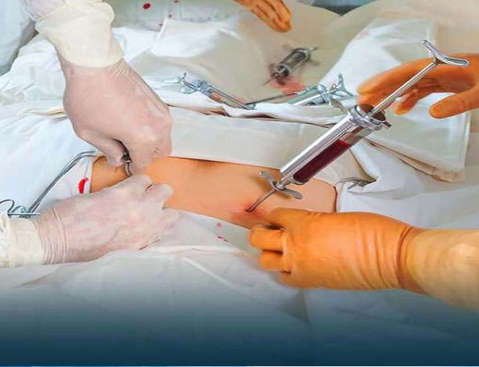 थैलीसीमिया मरीजों को राहत: निःशुल्क बोन मैरो ट्रांसप्लांट और 1250 रुपए मासिक पेंशन, बायोमेट्रिक जरूरी नहीं