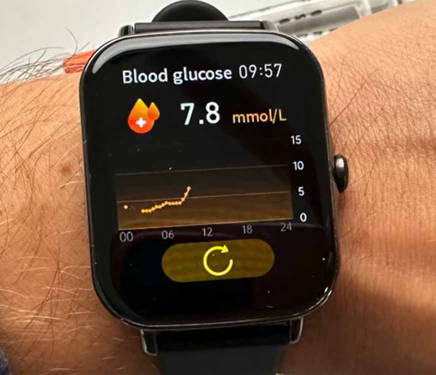 क्या स्मार्टवॉच से पता चलेगा डायबिटीज का खतरा? दुबई में शुरू हुआ खास टेक ट्रायल