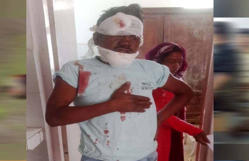 ब्रेकर में बाइक जैंपिंग होने से हादसा: चालक को आया गंभीर रूप से जख्म