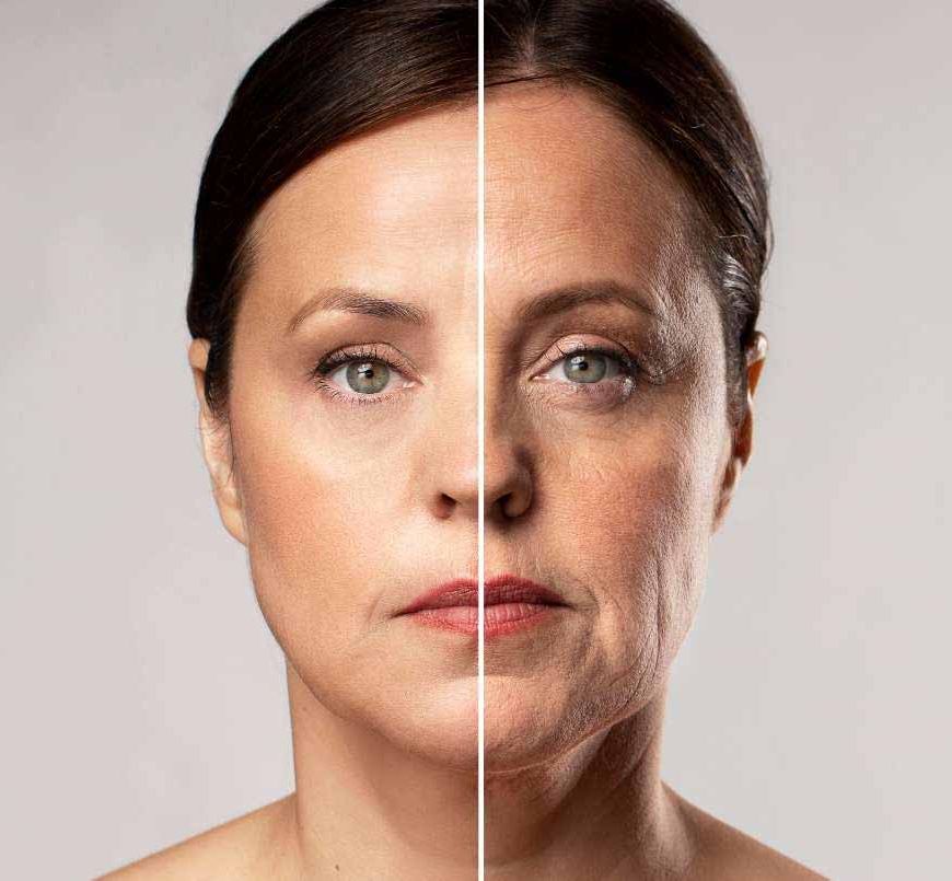 लटकती त्वचा और फाइन लाइन्स से छुटकारा चाहिए? फ्रीजर में रखी ये 1 चीज रातों-रात टाइट कर देगी चेहरा