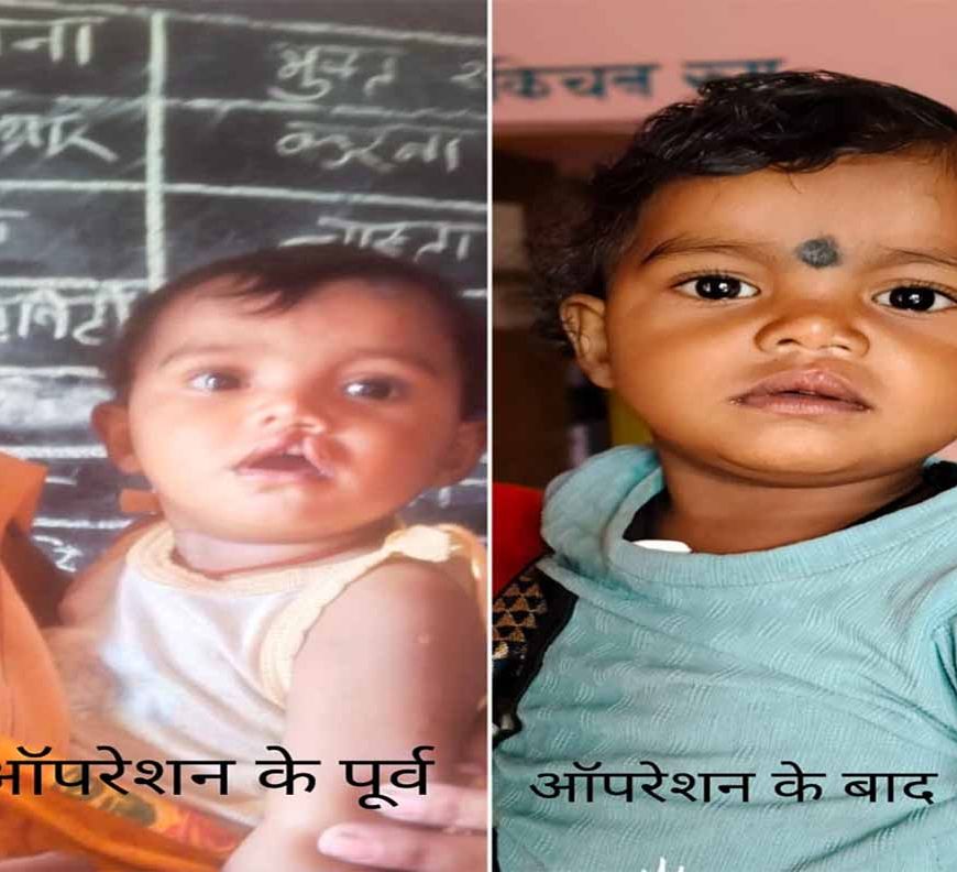 शासन की योजना से दूर हुई बेटी के भविष्य की चिंता, चिरायु दल ने लौटाई मासूम रंजना की मुस्कान