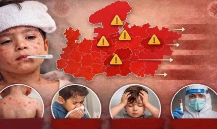 MP में खसरे की एंट्री: 4 जिलों में 12 नए मरीज, स्वास्थ्य विभाग अलर्ट मोड पर; घर-घर सर्वे शुरू