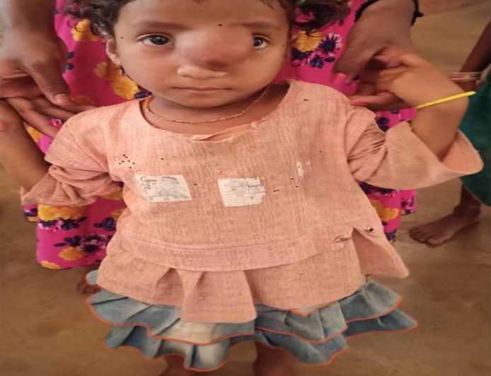 पिता के साये और आर्थिक तंगी के बीच चिरायु योजना बनी सहारा,अंजलि को मिला नया जीवन