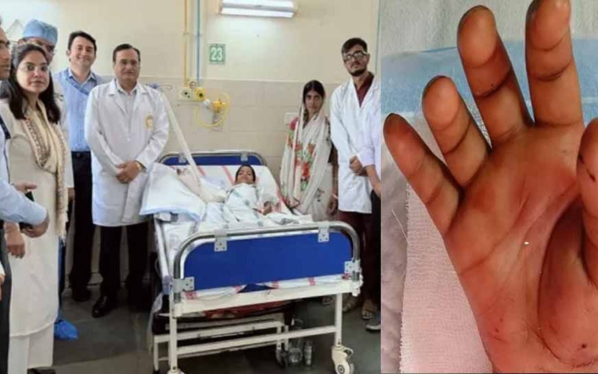 डॉक्टरों ने बच्ची का कटा हाथ जोड़ा, एम्स पटना में 6 घंटे चली सर्जरी