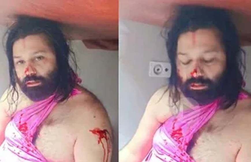 शंकराचार्य पर केस कराने वाले आशुतोष ब्रह्मचारी पर ट्रेन में जानलेवा हमला, नाक काटने की कोशिश