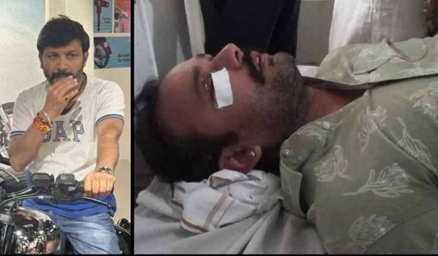 सतना में रोड टेंडर पर बवाल: हवाई फायरिंग के बाद पिस्टल की बट से हमला, CCTV खंगाल रही पुलिस