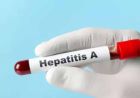 यूपी में हेपेटाइटिस ए का बड़ा खतरा, 97% सैंपल पॉजिटिव मिले