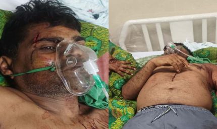 कुल्हाड़ी से हमला: गाली-गलौज का विरोध करने पर पूर्व जनपद सदस्य प्रतिनिधि पर जानलेवा वार