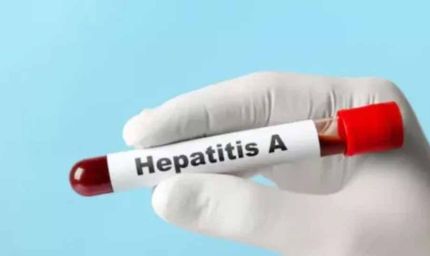 यूपी में हेपेटाइटिस ए का बड़ा खतरा, 97% सैंपल पॉजिटिव मिले