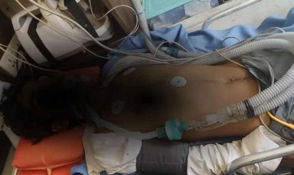 भिवाड़ी में पुलिस कस्टडी में नाबालिग से बर्बरता, हालत गंभीर, 4 पुलिसकर्मियों पर केस