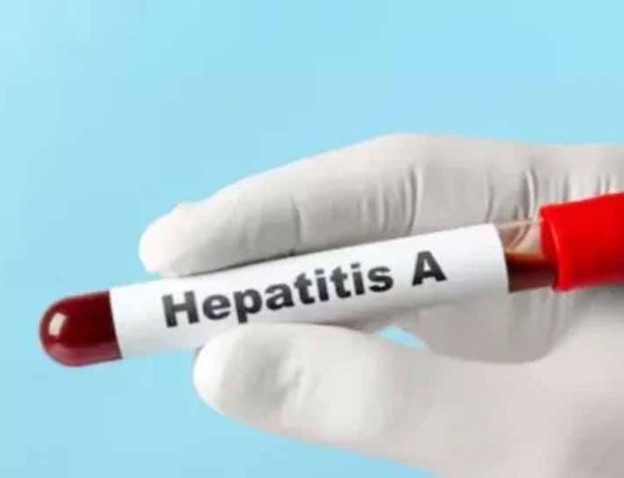 यूपी में हेपेटाइटिस ए का बड़ा खतरा, 97% सैंपल पॉजिटिव मिले