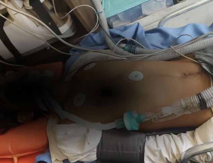 भिवाड़ी में पुलिस कस्टडी में नाबालिग से बर्बरता, हालत गंभीर, 4 पुलिसकर्मियों पर केस