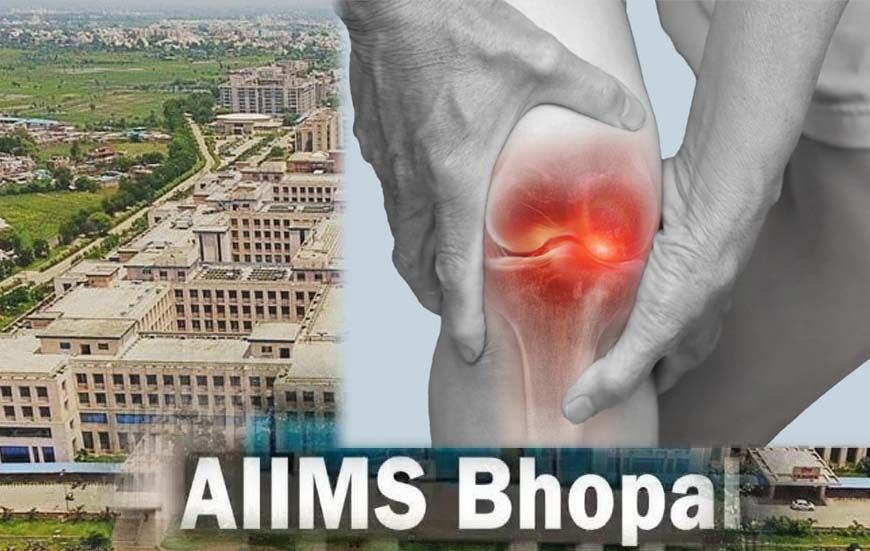 घुटनों के दर्द से मिलेगी परमानेंट मुक्ति, एम्स भोपाल और ग्वालियर आयुर्वेद संस्थान मिलकर खोजेंगे अचूक इलाज